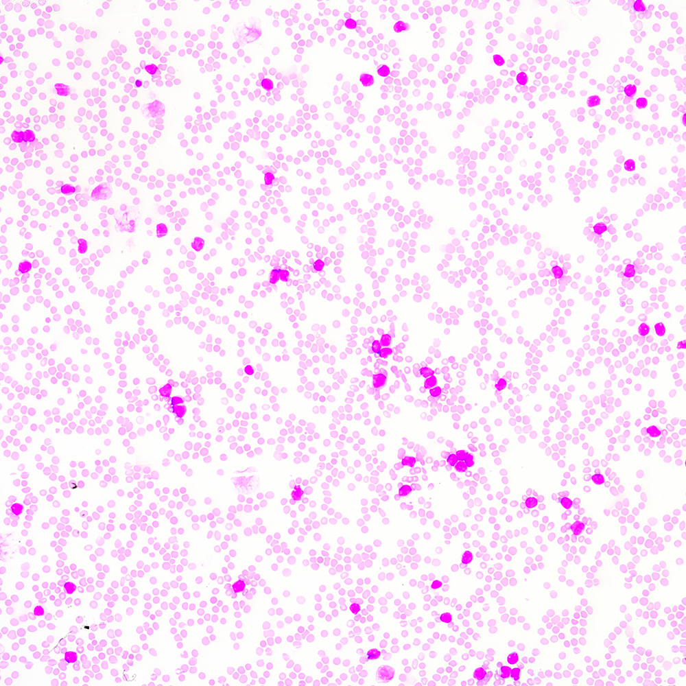 臺盼藍 VS AOPI：細胞活率計數，哪種染色更合你意？
